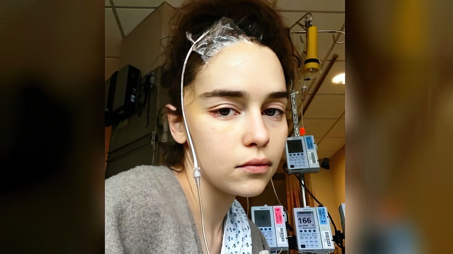 Devido a um aneurisma, Emilia Clarke foi submetida a três operações